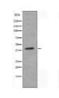 ALDOB Antibody