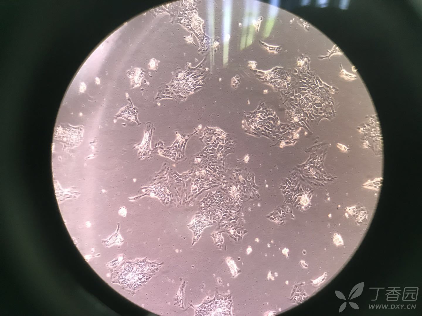 人胰腺导管细胞原代培养