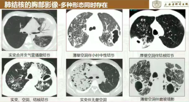 屏幕快照 2018-09-02 上午12.42.43.png