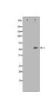 ALPL Antibody