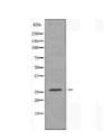 ANP32C Antibody