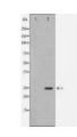 APCS Antibody