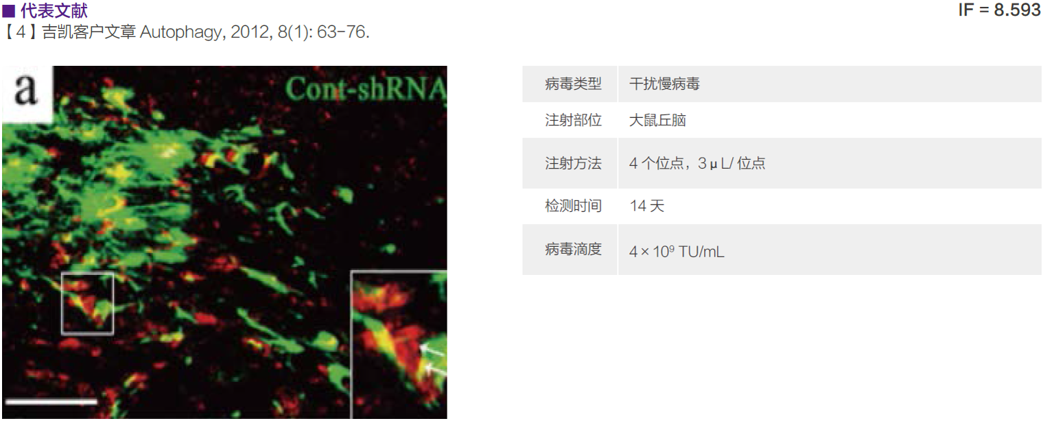 慢病毒应用于在体注射