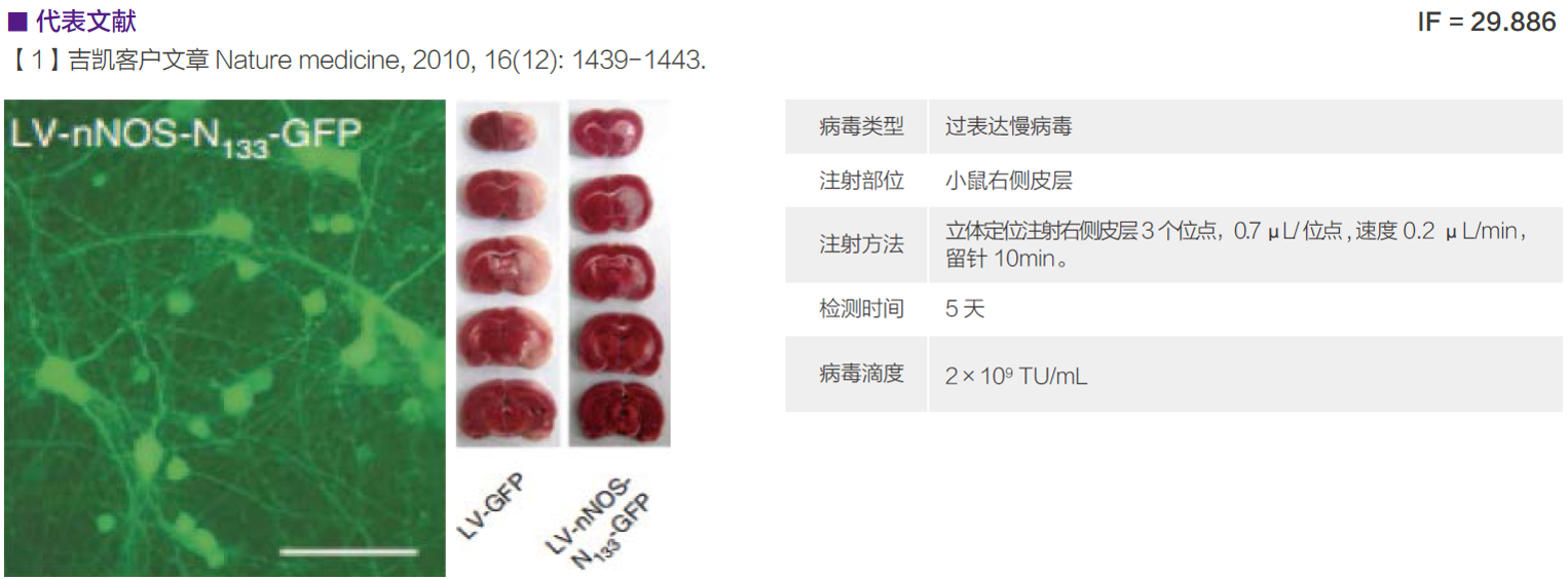 慢病毒应用于在体注射
