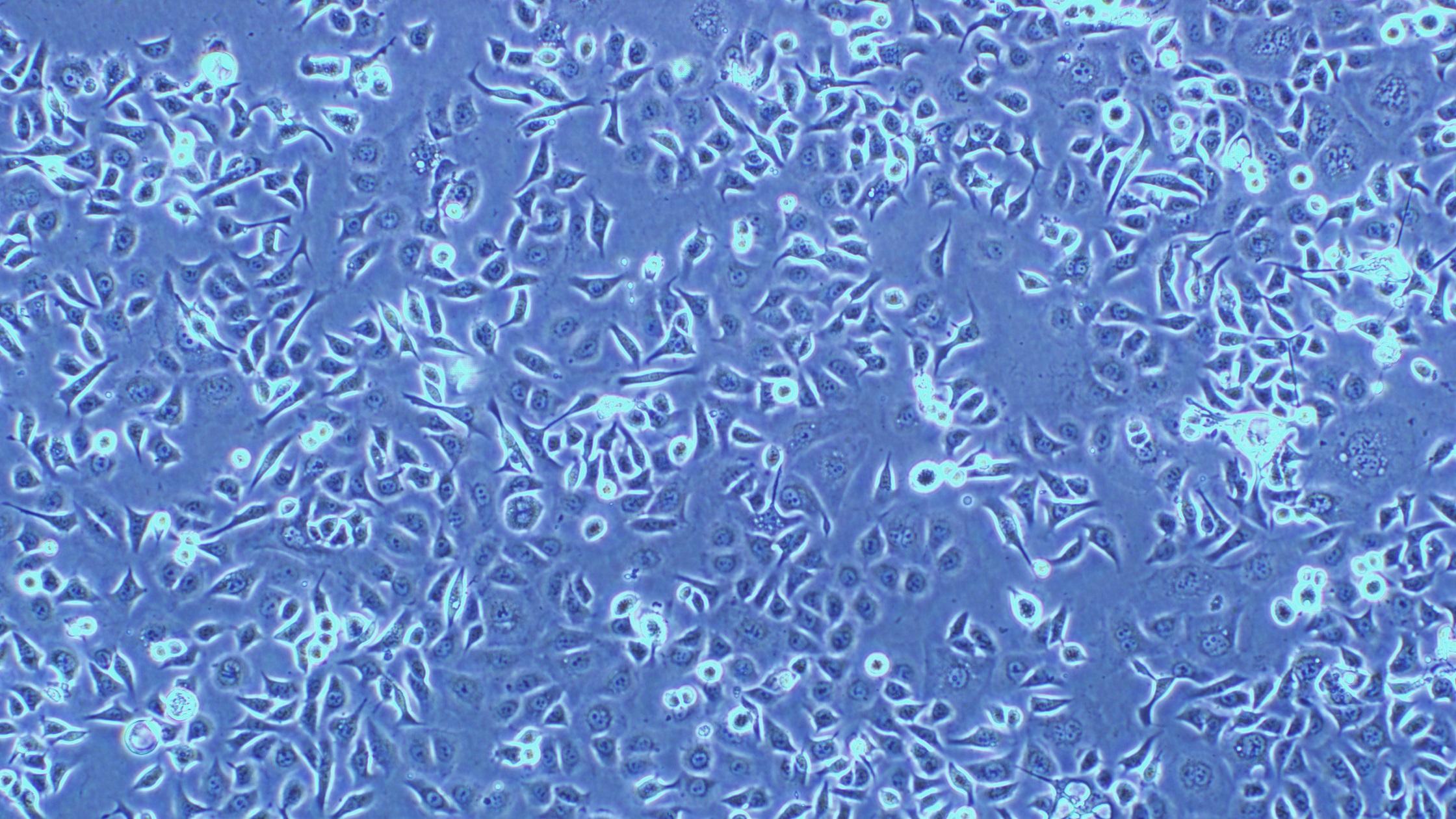 LADMAC小鼠骨髓淋巴细胞