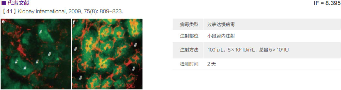 慢病毒应用于在体注射