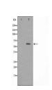 ATP6V1C2 Antibody