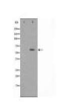 ATP6V1C2 Antibody