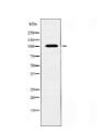 ATP2A1 Antibody