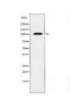 ATP2A1 Antibody