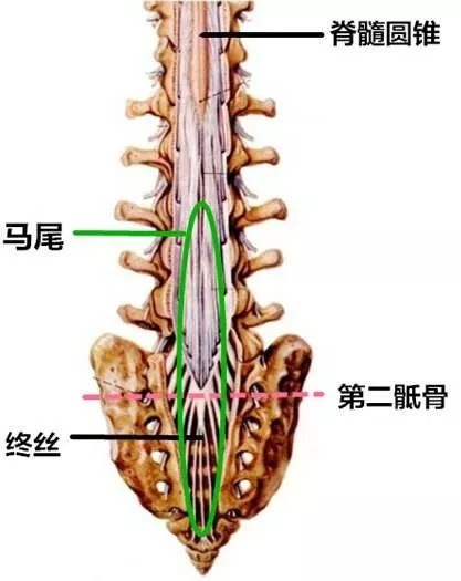 脊髓终丝图片