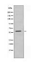 CCRL1 Antibody