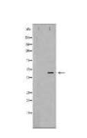 CHI3L1 Antibody