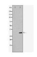 CDKN1C Antibody