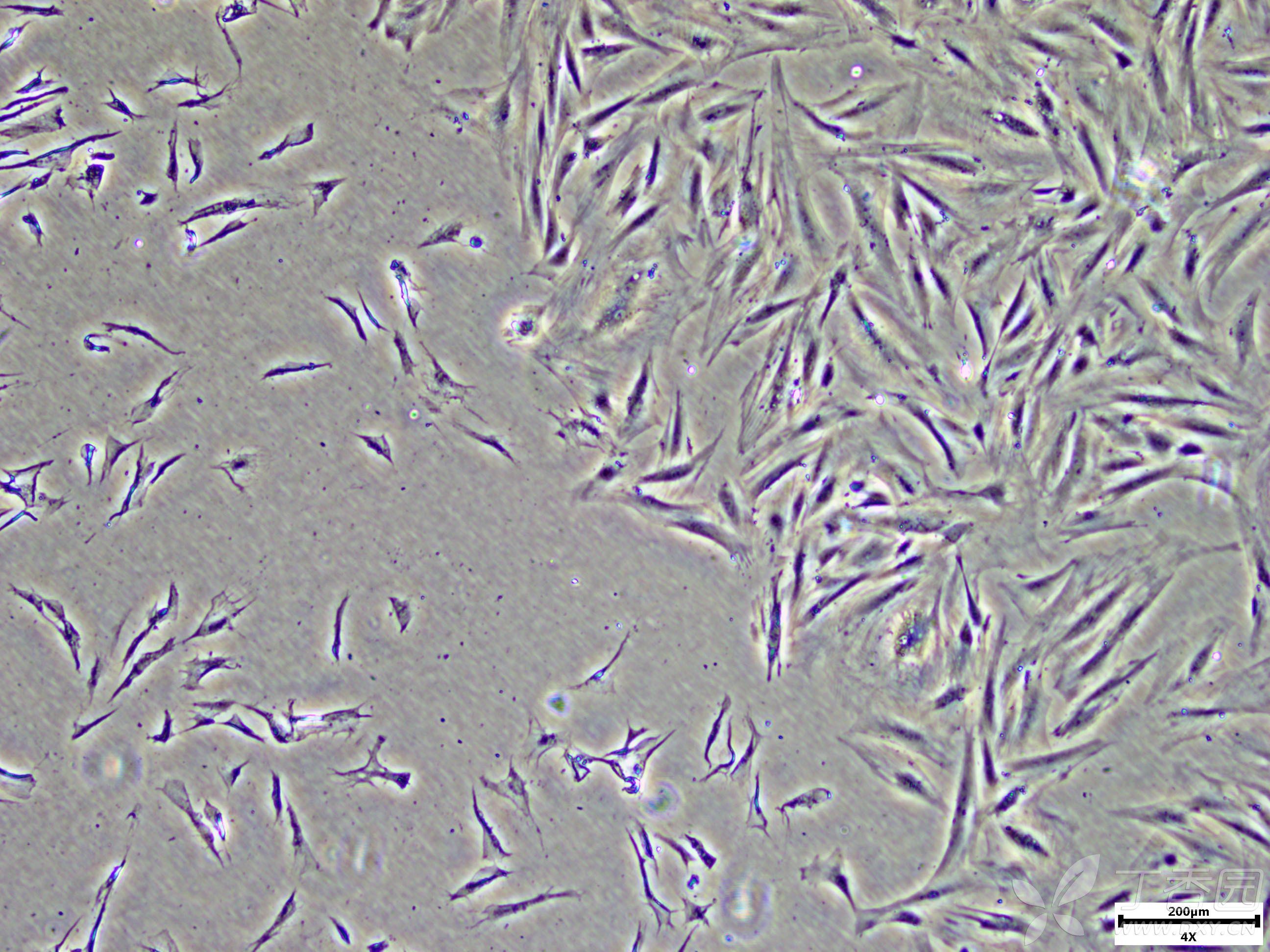 2正常大鼠皮肤成纤维细胞与形态异常的大鼠成纤维细胞交界