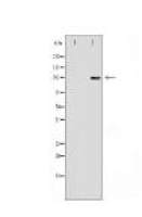 CDH2 Antibody