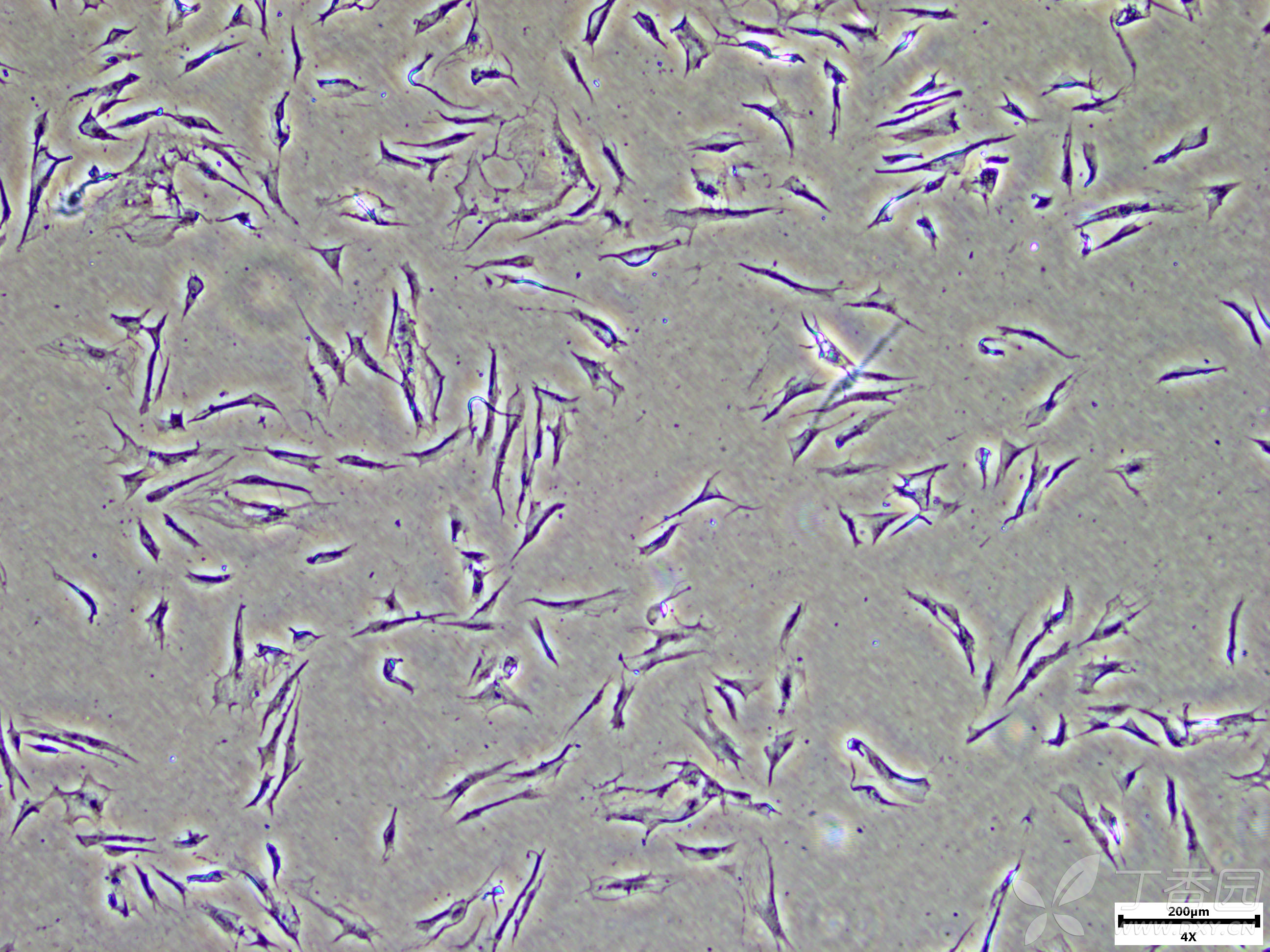 3形态异常的大鼠成纤维细胞