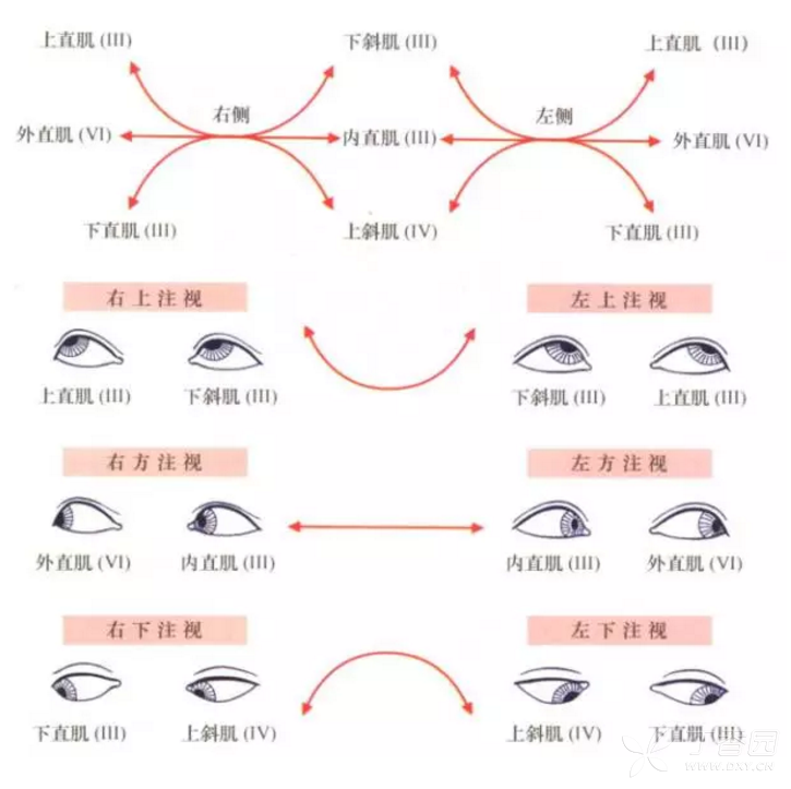 右侧颞部头痛及右眼部疼痛 上斜肌麻痹=痛性眼肌麻痹? [病例帖]