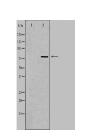 CEP78 Antibody