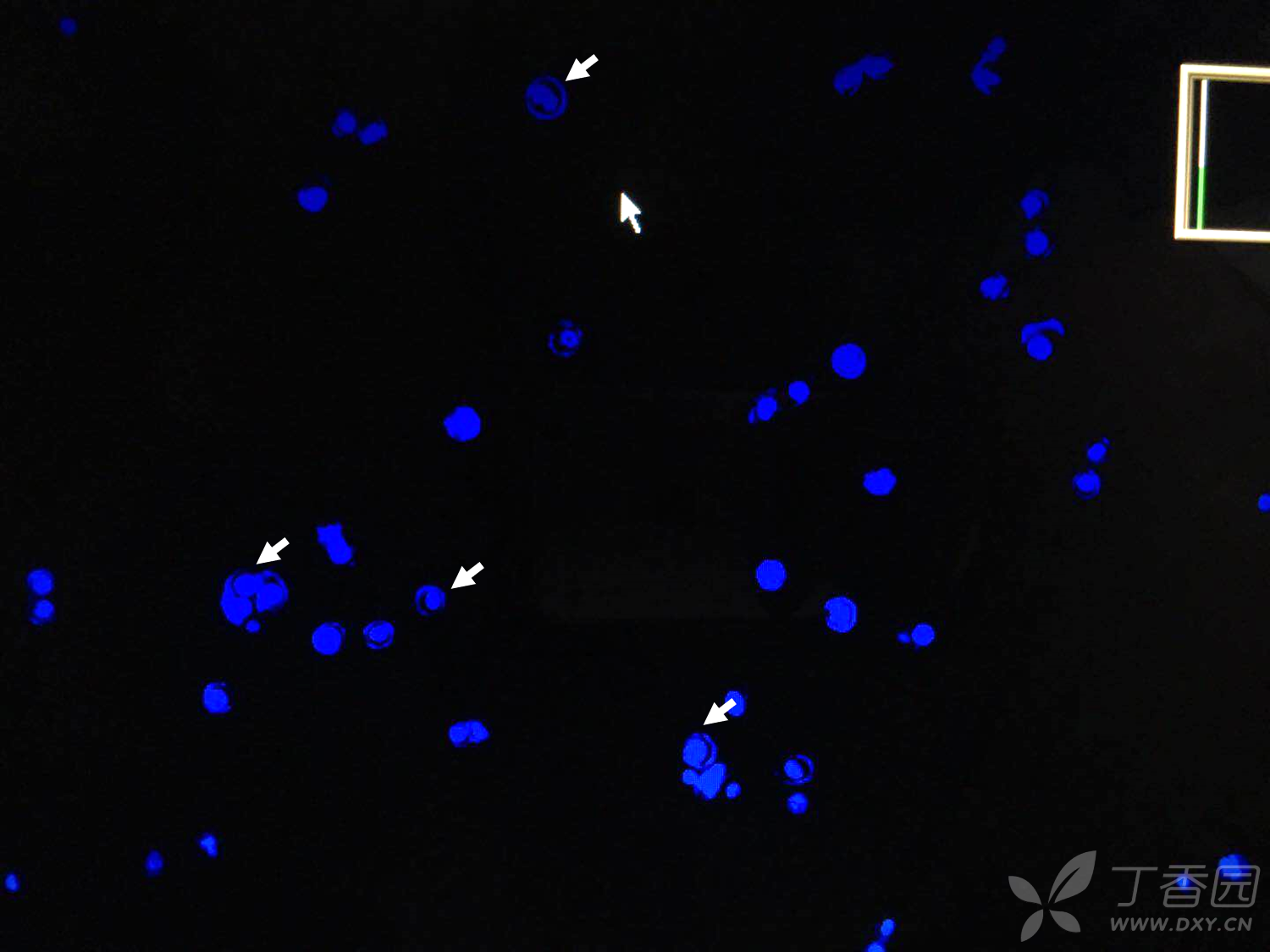 请问各位站友,dapi然出来为什么是这样的,周边有个圆圈.感谢各位!
