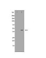 CSNK2A2 Antibody
