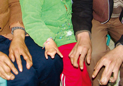 https://img1.dxycdn.com/2018/0907/899/3299193714177763347-22.jpg
