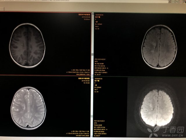 3299427826402889185-16w.jpg!w640