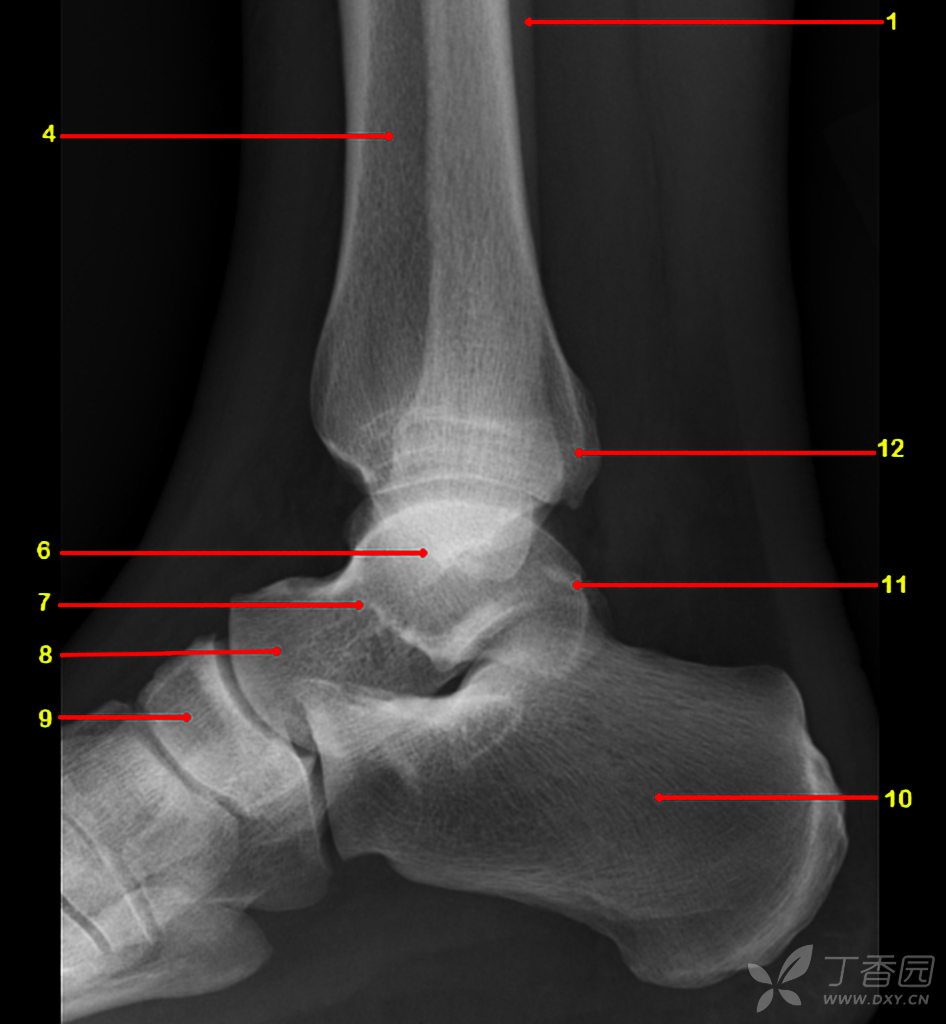 踝关节骨骺图片