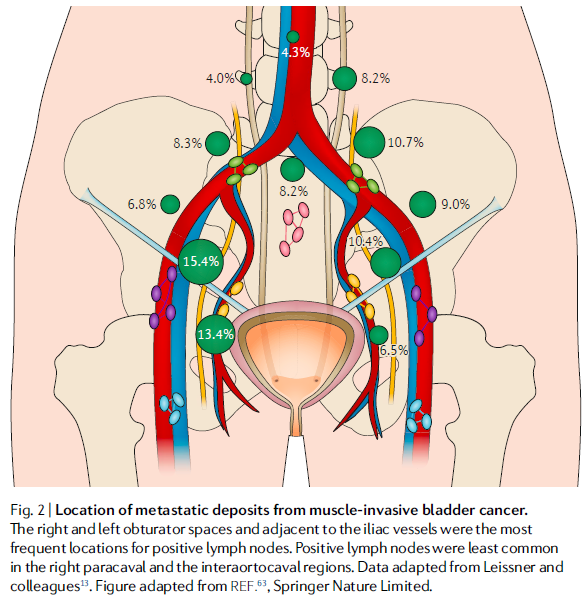 盆腔淋巴结解剖图图片