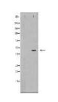 CTSE Antibody
