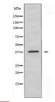 CYSLTR1 Antibody