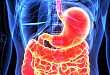 Medscape 精选 | 胃肠道的免疫介导不良反应的治疗