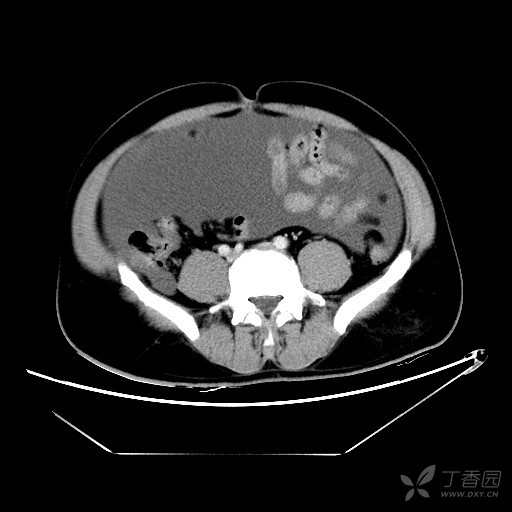 猜成语囊什么_看图猜成语(2)