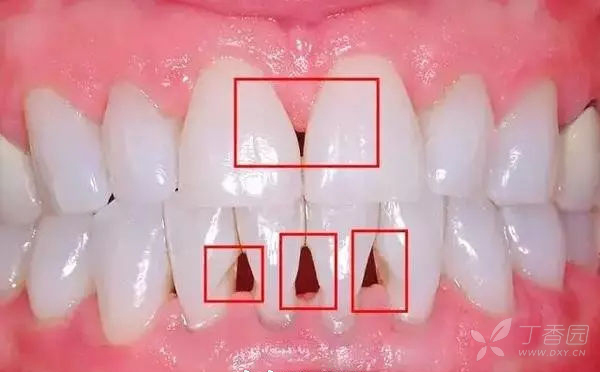 3299942954042934801-8w.jpg