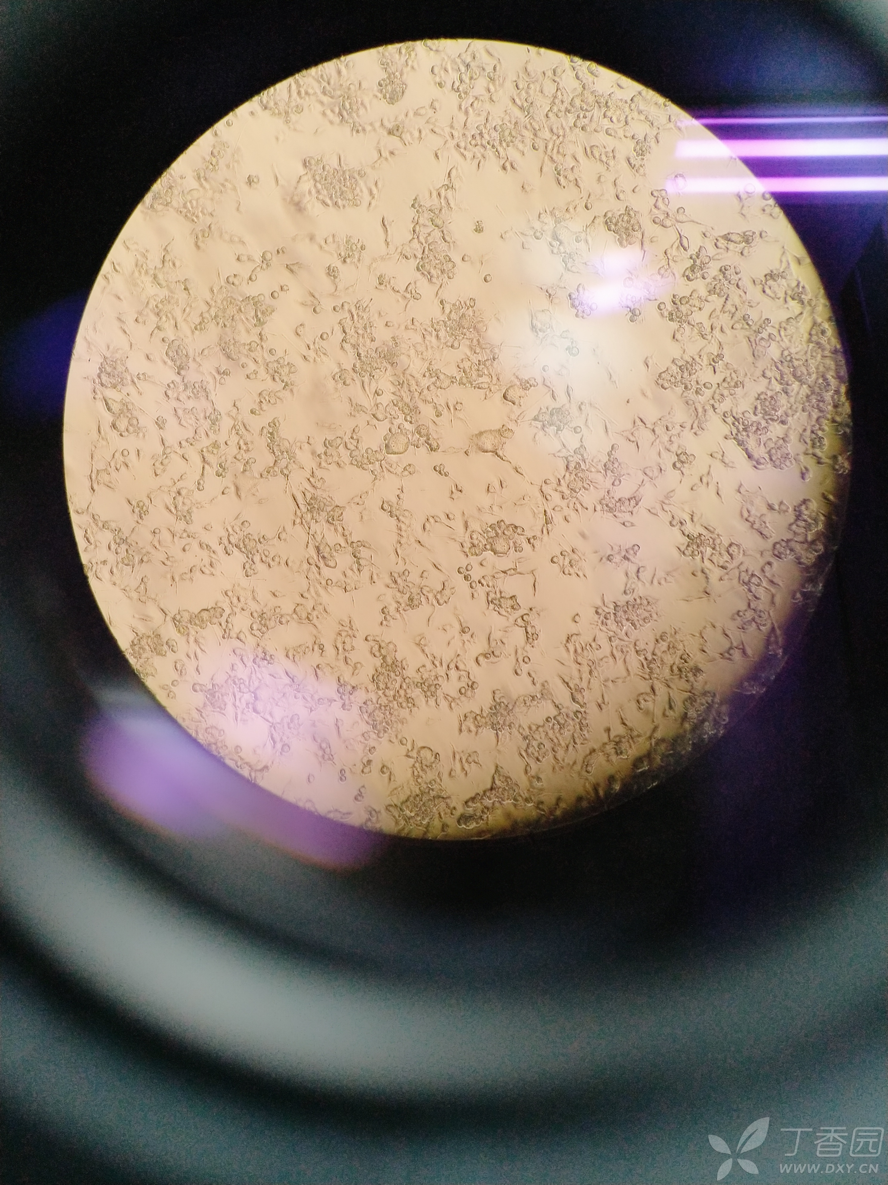 本人刚开始养bv-2细胞,请各位前辈指教,今天在显微镜下看到有个别较大