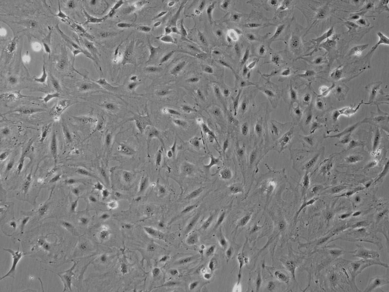 RBL-1 大鼠嗜碱性粒细胞性白血病细胞