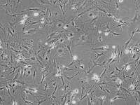 LLC小鼠肺癌细胞