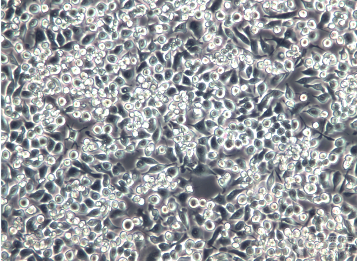 这个细胞是悬浮 贴壁的,图片看应该是没有吹打均匀,细胞本身是不大的.