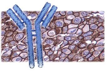 FITC标记的钙结合样蛋白/神经内分泌肿瘤标记物抗体
