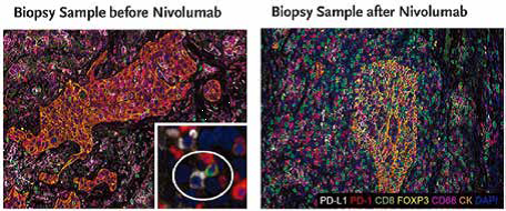肿瘤免疫与个性化医疗——暨第二届生化工程国家重点实验室珀金埃尔默转化医学年会