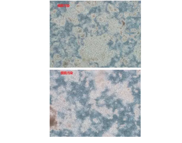 哈？细胞又污染了？这里有一份祖传的鉴污宝典