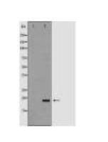 FTL Antibody