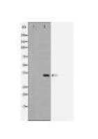 FCER2 Antibody