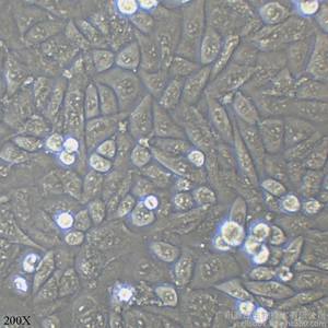 OS-RC-2人肾癌细胞 （通过STR鉴定) 