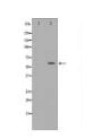 GGT1 Antibody