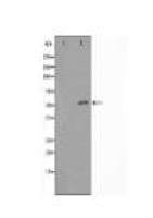 GSDMC Antibody