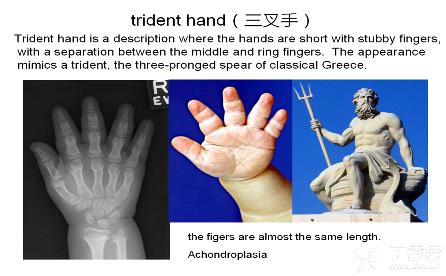 trident hand(三叉手) 09-20 11:25          关注      全部讨论(2)