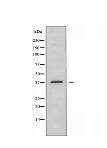 HOXB2 Antibody