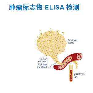 肿瘤标志物检测ELISA试剂盒