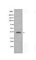 HOXA1 Antibody